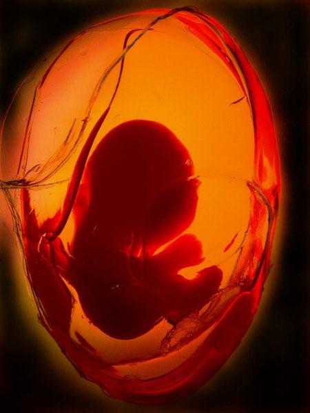 pre-natal fertility