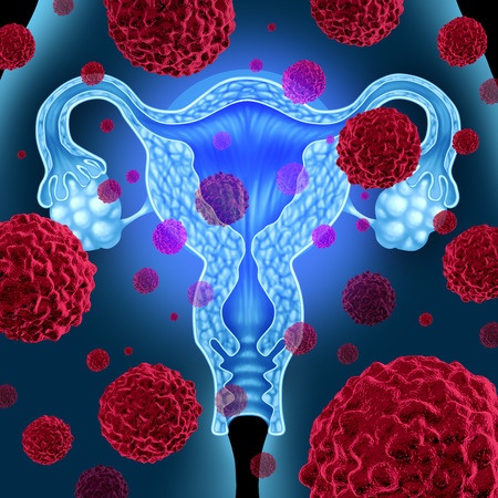 Important Facts You Need To Know About Cervical Cancer