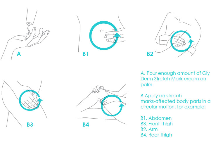 Directions for Gly Derm stretch mark cream