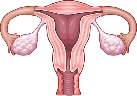 What is endometriosis