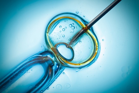In-vitro fertilization