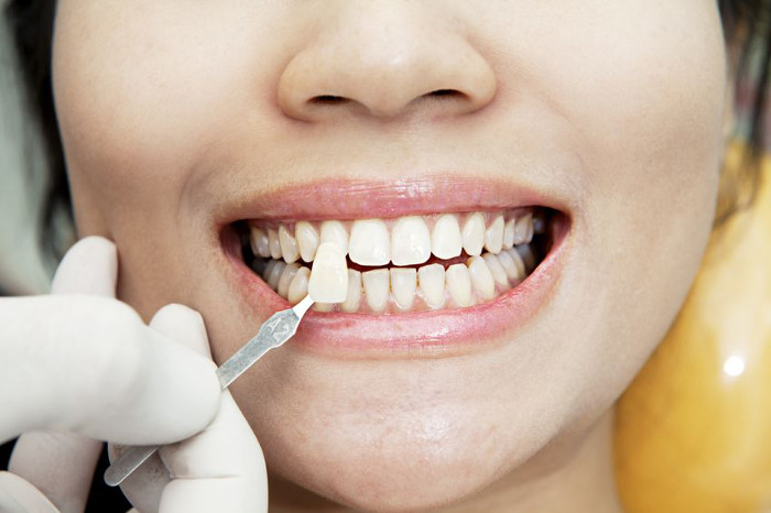 lady getting her teeth checked