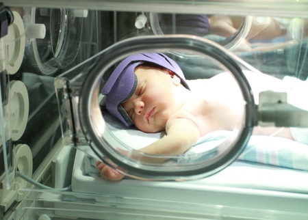 treatment for jaundice baby