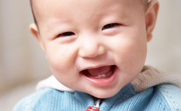 what is baby tooth decay