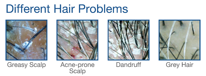 common-hair-problems