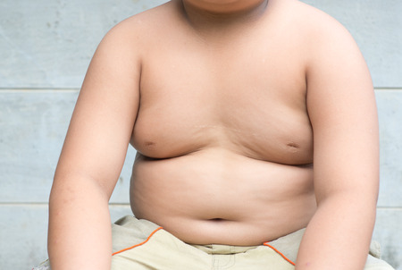 Childhood Obesity Facts To Know