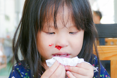 How To Stop Nose Bleeds In Children