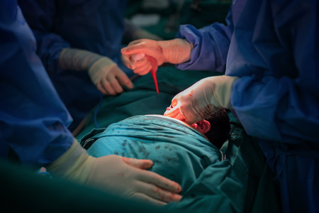 C-section Pros and Cons
