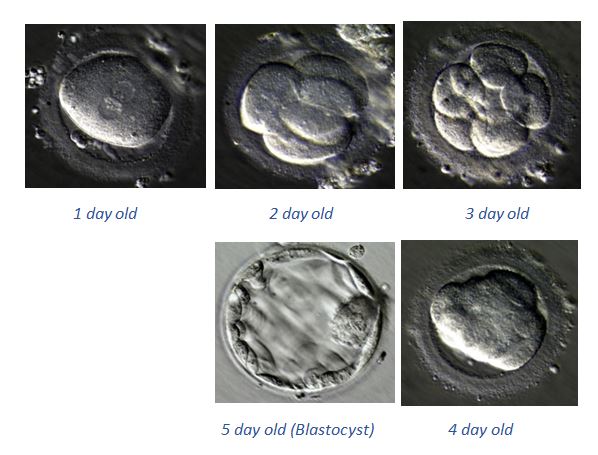 IVF Step by step procedure