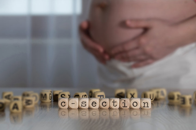 Caesarean section procedure