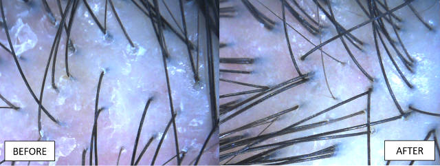 Hair treatment Topp Care Before After
