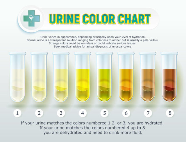 Urine colour chart that shows how dehydrated your child is