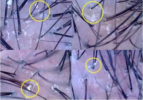 TK TrichoKare Hair and Scalp Analysis Pre