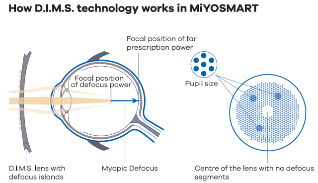 MiYOSMART DIMS Technology