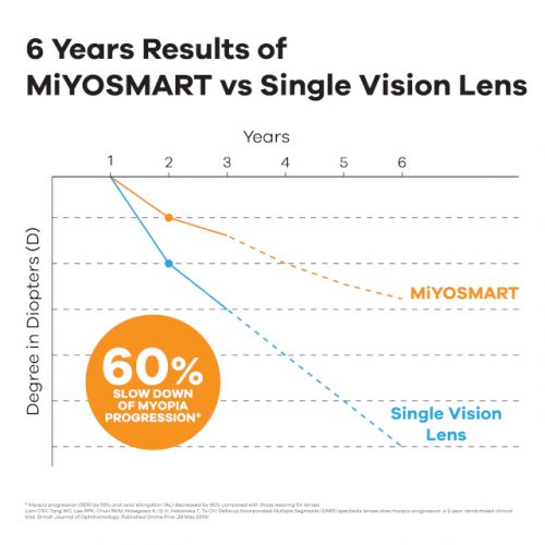 MiYOSMART HOYA vs Single Lens