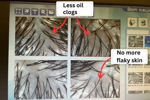 TK TrichoKare hair and scalp analysis