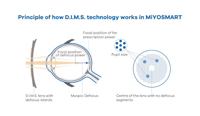 HOYA MiYOSMART lenses D.I.M.S. Technology