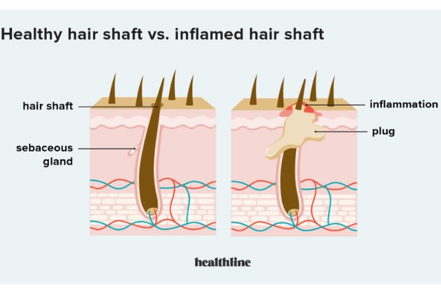 Hair and Scalp analysis Healthline