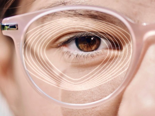 ZEISS Myopia Management Lens