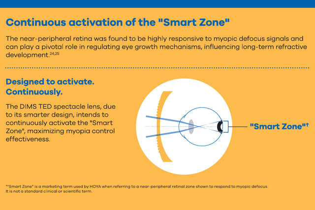 MiYOSMART iQ Smart Zone Illustration